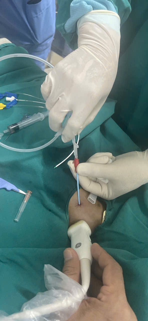 Các bác sĩ can thiệp để cứu bệnh nhân - Ảnh BVCC