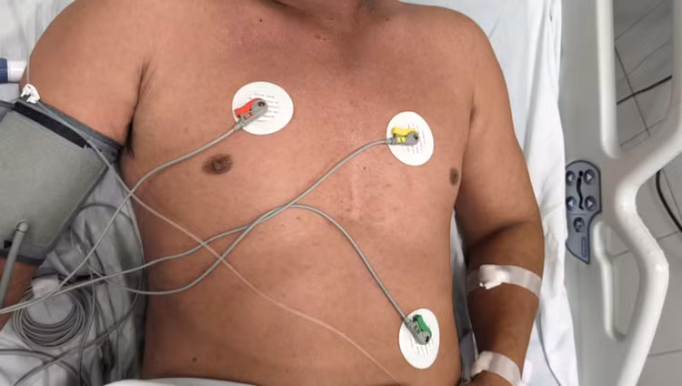 Suy hô hấp cấp do mắc sởi - Ảnh BVCC