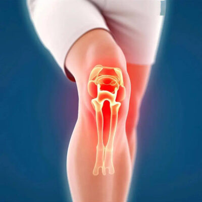 Khớp đau tăng khi trời lạnh - Ảnh BSCC