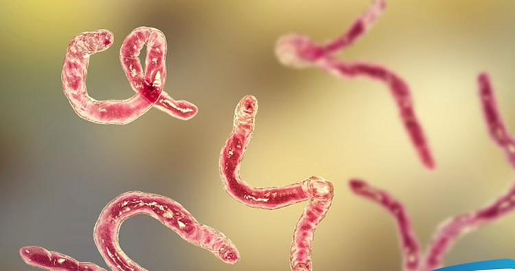 7 lời khuyên từ bác sĩ để phòng tránh nhiễm ký sinh trùng ảnh 1