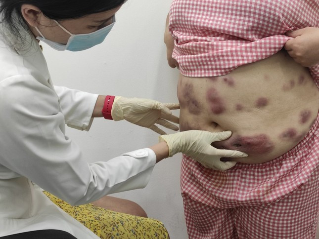 BSCK2 Phạm Thị Thanh Giang thăm khám cho bệnh nhân.