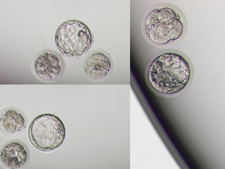 Kết quả phôi thu được của vợ chồng anh D. được đánh giá khá tốt