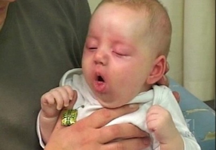 Một số lưu ý khi chăm sóc trẻ bệnh ho gà tại nhà tránh biến chứng - Ảnh Minh họa