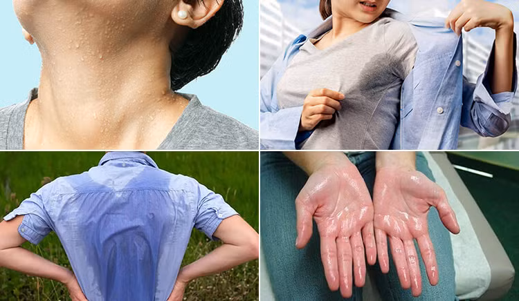 Dù đông hay hè, đổ mồ hôi các kiểu này cần đi viện ngay - Ảnh minh hoạ