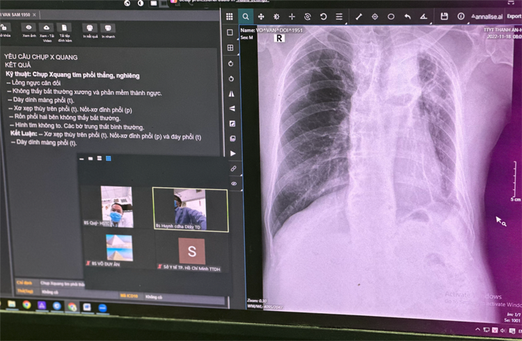 Bác sĩ trẻ sử dụng máy X-quang tích hợp AI tại Trạm y tế xã đảo Thanh An Bác sĩ trẻ sử dụng máy X-quang tích hợp AI tại Trạm y tế xã đảo Thanh An