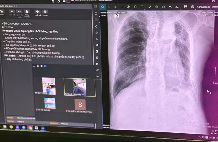 Bác sĩ trẻ sử dụng máy X-quang tích hợp AI tại Trạm y tế xã đảo Thanh An