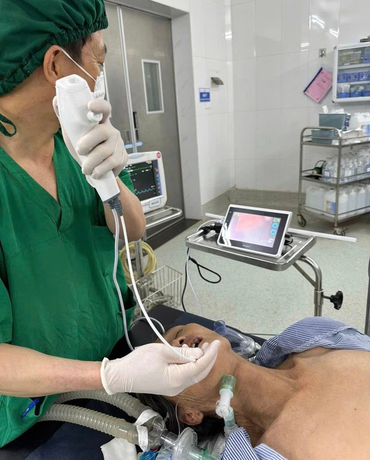 Các bác sĩ thực hiện đặt nội soi ống mềm gây mê cho người bệnh - Ảnh BVCC