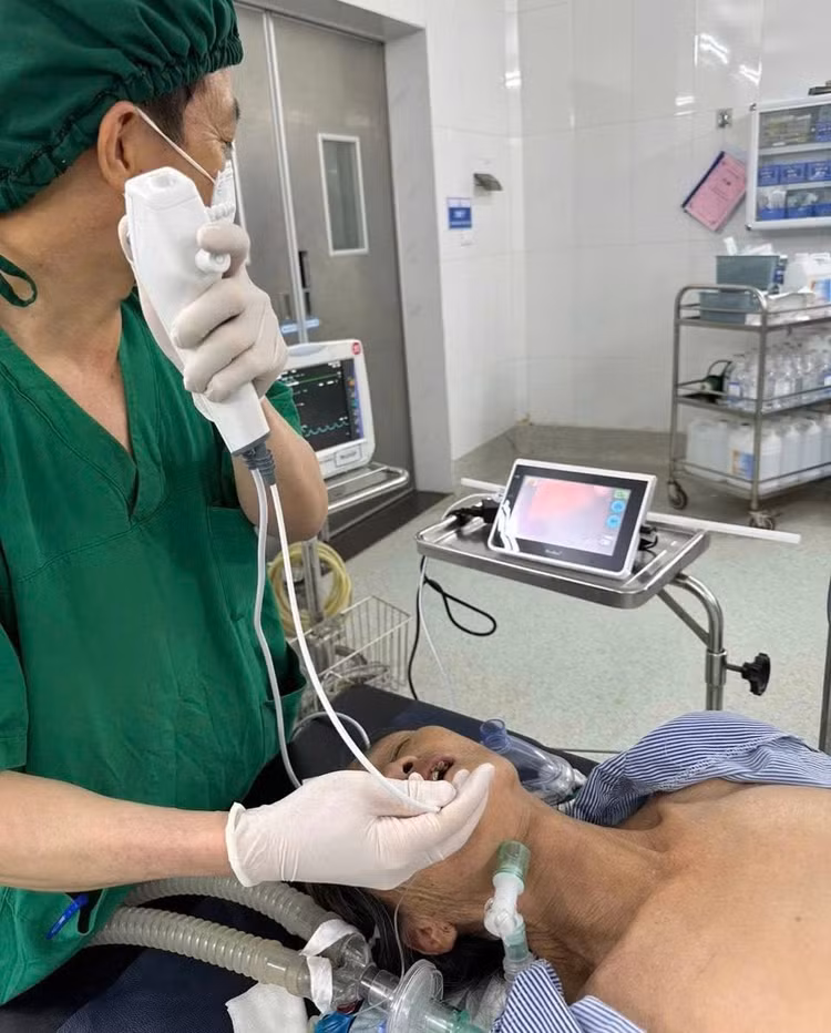 Các bác sĩ thực hiện đặt nội soi ống mềm gây mê cho người bệnh - Ảnh BVCC