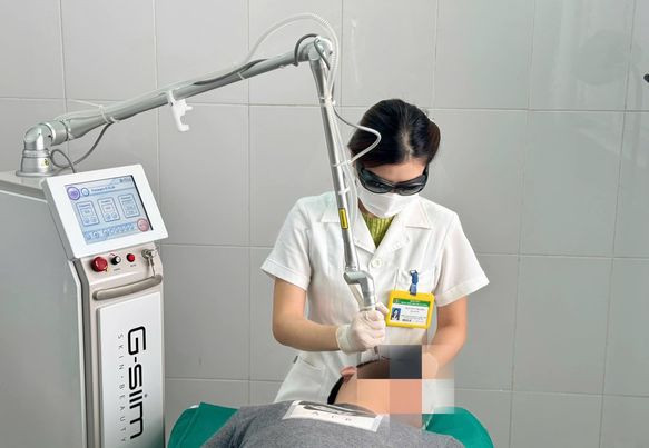 Laser CO2 điều trị dày sừng da dầu, các nốt nâu, đen trên mặt ảnh 2