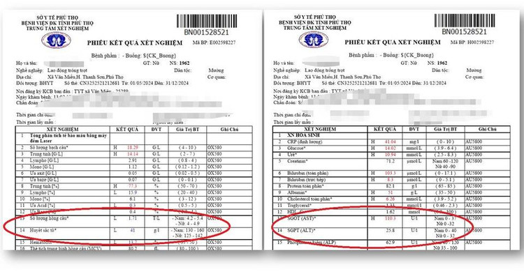 Hinh ảnh kết quả kết nghiệm của người bệnh khi nhập viện