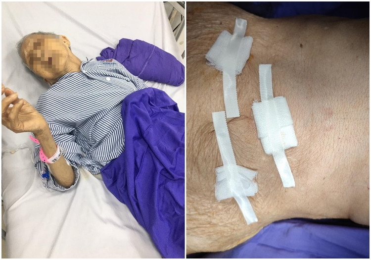 Cụ bà 104 tuổi bị thoát vị bịt nguy hiểm được cứu sống thần kỳ ảnh 2