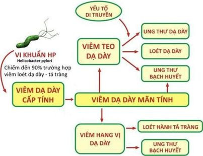 70% dân số dương tính với HP dạ dày: Bác sĩ mách cách bảo vệ 70% dân số dương tính với HP dạ dày: Bác sĩ mách cách bảo vệ