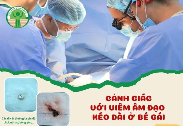 Phẫu thuật lấy dị vật âm đạo cho các bé gái - Ảnh BVCC