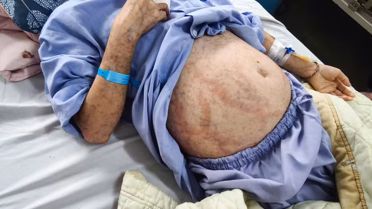 Bệnh nhân bị dị ứng nặng, phù nề toàn thân - Ảnh BVCC