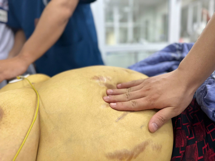 Thăm khám cho người bệnh viêm gan B biến chứng - Ảnh BVCC