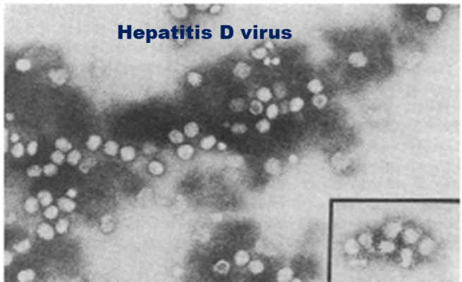 Xét nghiệm viêm gan virus D - Ảnh BSCC