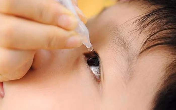 Hình ảnh nhỏ mắt cho trẻ bằng nước muối sinh lý - Ảnh minh hoạ