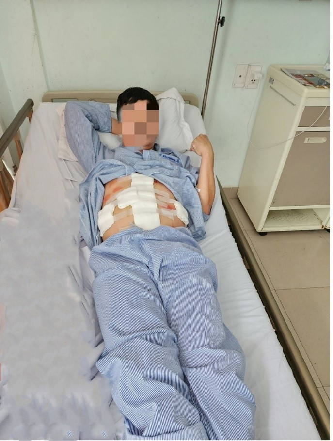 Người bệnh được điều trị hậu phẫu tại Khoa Phẫu thuật kỹ thuật cao theo yêu cầu