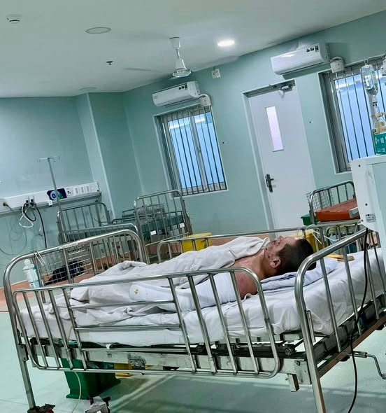 Trẻ 12 tuổi sốc đa chấn thương do bỏng 40% diện tích cơ thể - Ảnh BVCC