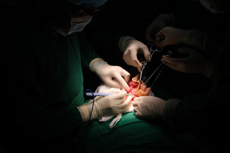 Cắt bỏ bướu giáp khổng lồ đeo bám 40 năm ở cụ bà 92 tuổi ảnh 2