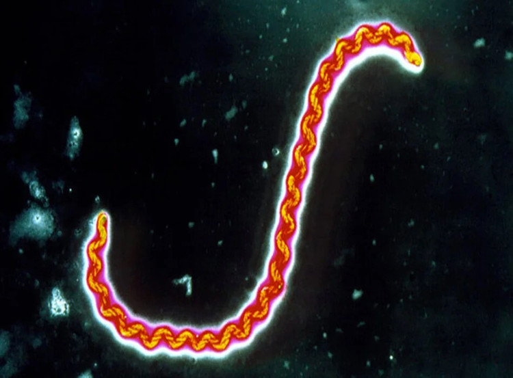 Xoắn khuẩn Leptospira Xoắn khuẩn Leptospira