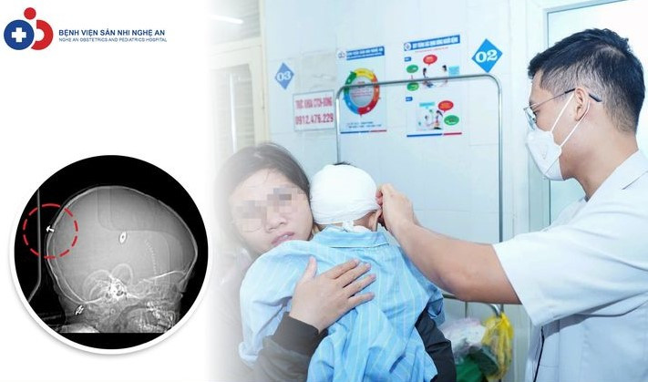 Bác sĩ thăm khám cho bệnh nhân sau phẫu thuật - Ảnh BVCC