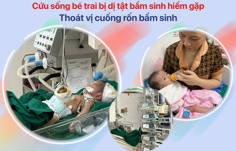 3 lần mổ cứu trẻ sơ sinh bị nội tạng thòi hết ra khỏi ổ bụng - Ảnh BVCC