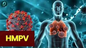Virus HMPV gây viêm phổi - Ảnh minh họa