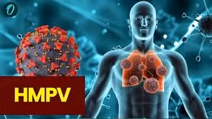 Virus HMPV gây viêm phổi - Ảnh minh họa