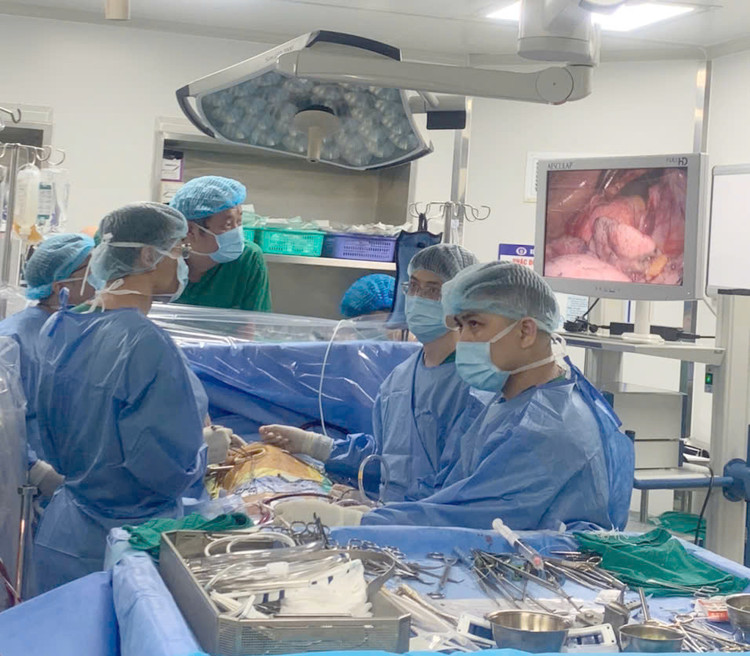 Ê-kíp phẫu thuật khoa Phẫu thuật tim mạch – Lồng ngực thực hiện kỹ thuật phẫu thuật nội soi cắt u nhầy ở tim (Tâm nhĩ phải) cho người bệnh - Ảnh BSCC