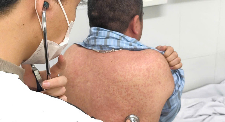 Thăm khám cho bệnh nhân bị sởi - Ảnh BVCC Thăm khám cho bệnh nhân bị sởi - Ảnh BVCC