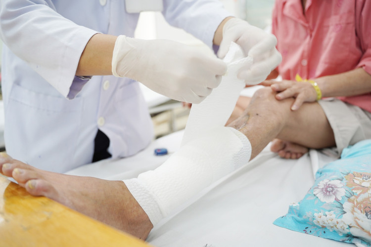 Bệnh nhân bị tổn gãy hở hai xương cẳng chân trái và khuyết hổng mô mềm mức độ nặng - Ảnh BVCC