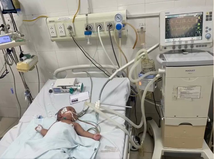 Bé trai gần 1 tuổi bị bỏng nhiễm khuẩn huyết nguy hiểm - Ảnh cắt từ video Bé trai gần 1 tuổi bị bỏng nhiễm khuẩn huyết nguy hiểm - Ảnh cắt từ video