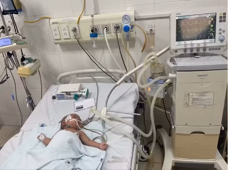 Bé trai gần 1 tuổi bị bỏng nhiễm khuẩn huyết nguy hiểm - Ảnh cắt từ video