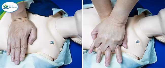 Cách ép tim cho người đuối nước