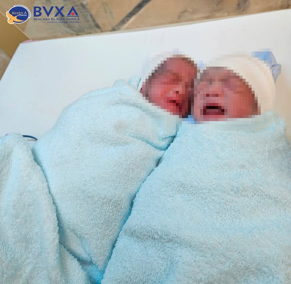 2 bé bị truyền máu song thai ra đời khỏe mạnh - Ảnh BVCC