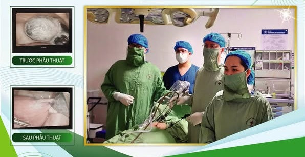 Ca phẫu thuật nội soi tháo buồng trứng xoắn cho thai phụ - Ảnh BVCC