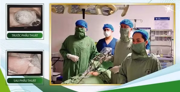 Ca phẫu thuật nội soi tháo buồng trứng xoắn cho thai phụ - Ảnh BVCC
