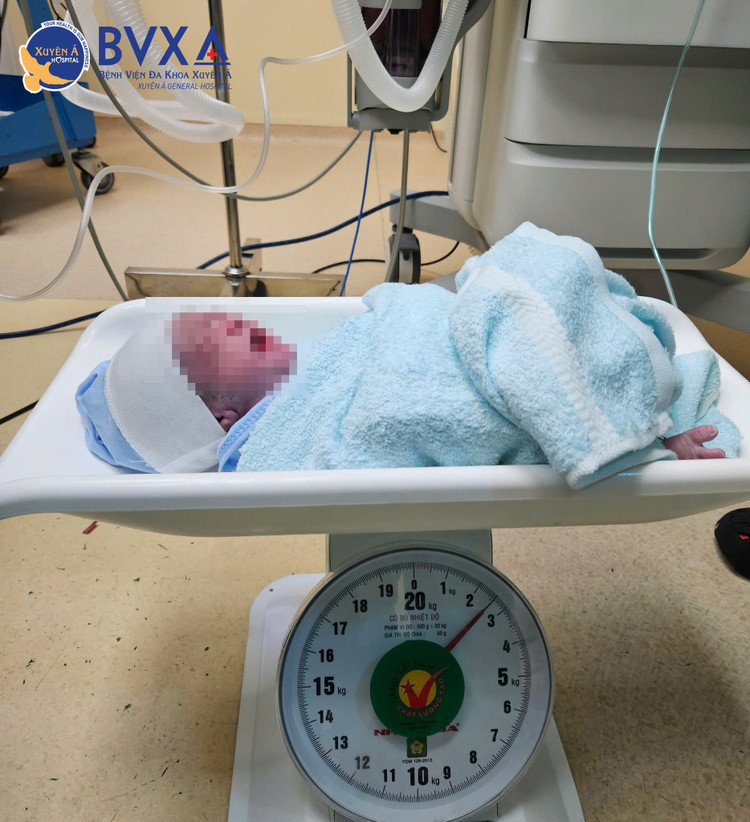 Hy hữu, cặp song sinh mắc hội chứng truyền máu song thai, ra đời khỏe mạnh ảnh 2