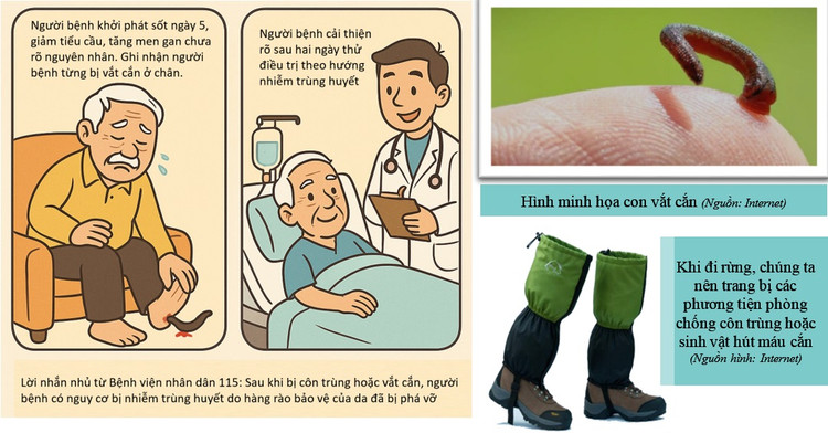 Đi rừng bị “vết cắn nhỏ” người đàn ông suýt tử vong vì nhiễm trùng huyết - Hình minh họa BVCC