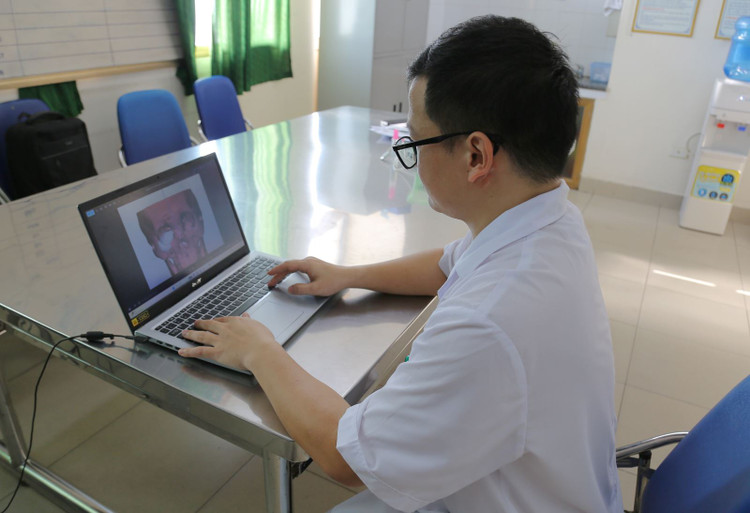 Bác sĩ ứng dụng công nghệ dựng hình 3D hiện đại để chuẩn bị kế hoạch phẫu thuật tạo hình thành ổ mắt cho bệnh nhân H. đảm bảo chính xác, tối ưu nhất - Ảnh BVCC