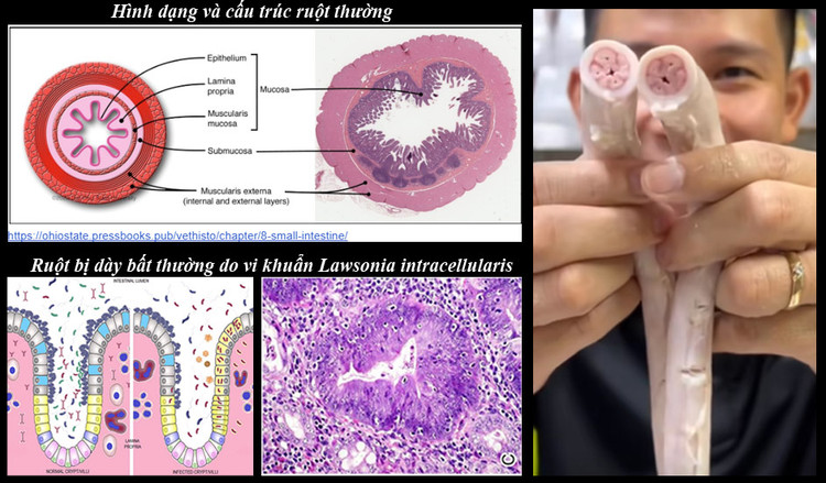 Ảnh minh họa - bác sĩ cung cấp. Ảnh minh họa - bác sĩ cung cấp.