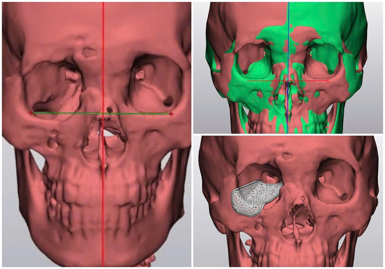 Ứng dụng công nghệ dựng hình 3D và thuật toán ánh xạ hình ảnh tiên tiến - Ảnh BVCC