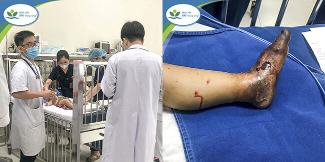 Thời điểm trẻ nhập viện tại Khoa Cấp cứu và Chống độc