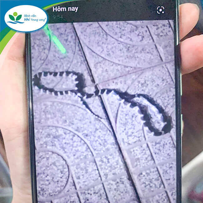 Hình ảnh rắn cạp nia gia đình cung cấp