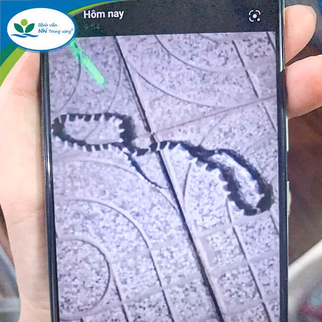 Hình ảnh rắn cạp nia gia đình cung cấp