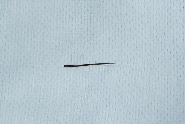 Xương cá đã được lấy ra.