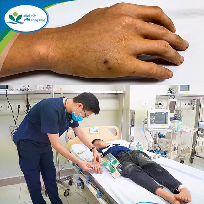 Bé trai Q.H đang được chăm sóc tích cực tại Khoa Cấp cứu và Chống độc