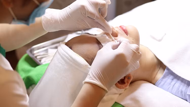 Chuyên da chỉ rõ 7 nguyên tắc giúp bạn trị mụn trứng cá hiệu quả.