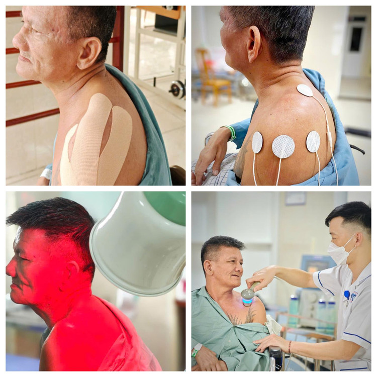 Vai người bệnh đã phục hồi tốt sau 3 tháng tập phục hồi chức năng - Ảnh BVCC